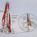 Zespół mięśnia biodrowo-lędźwiowego