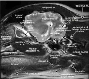 Meridian Zarządzający DU20
