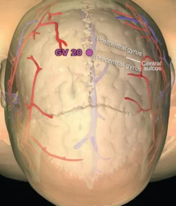 Meridian Zarządzający DU20